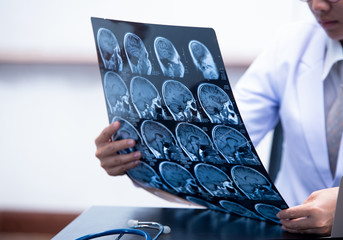 doctor looking at brain scans